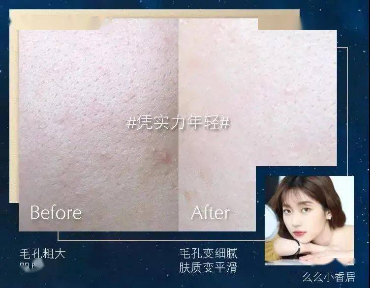 节日全年仅一次！888元到手雅诗兰黛限定礼盒，一次get精华、眼霜、眼影... 12件明星单品限量抢！