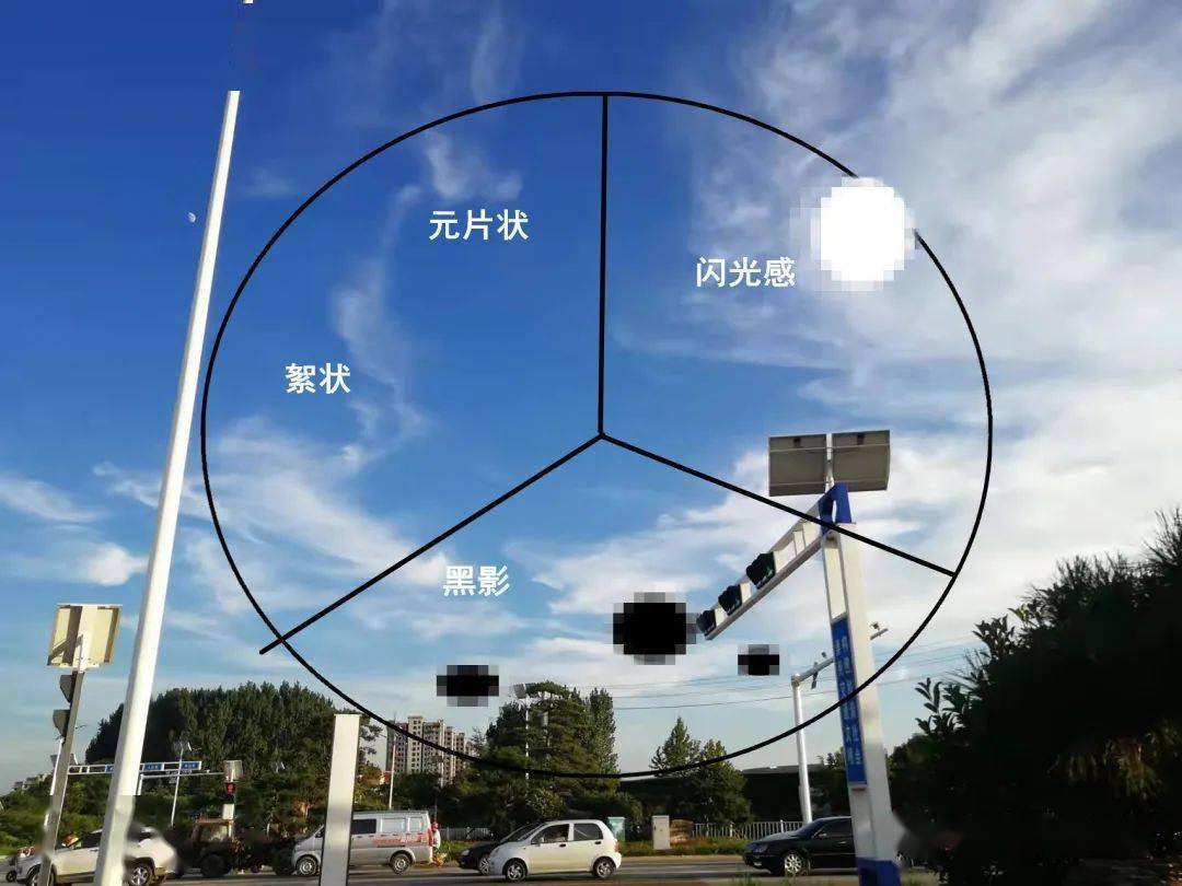 【医说健康】只有老人才会有"飞蚊症"吗?_玻璃体_视网膜_液化