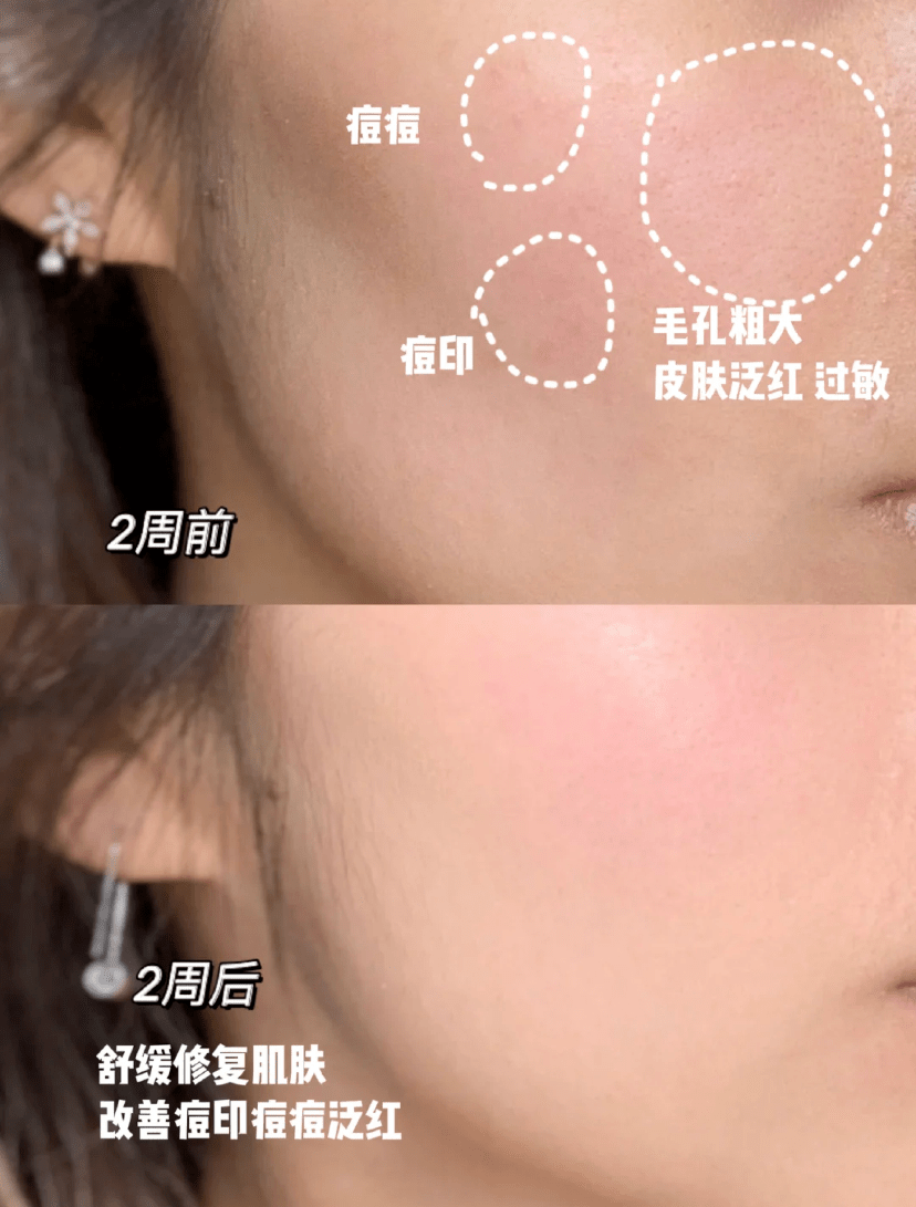 凤凰草奶油色，穿上身太美了！