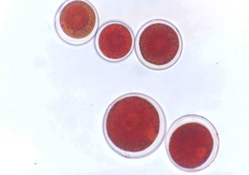 雨生红球藻虾青素对视觉调节和眼疲劳的作用