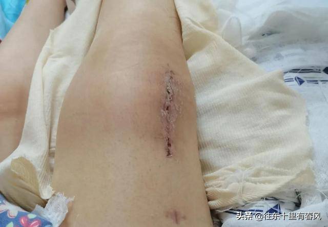 18岁骨癌少女夏夏既然上了生活的贼船何不做个勇敢的海盗