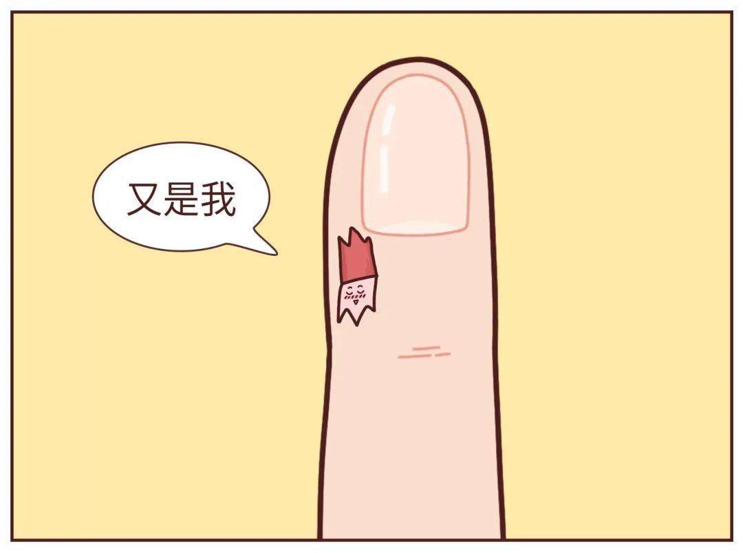 手指老长倒刺是缺维生素吗