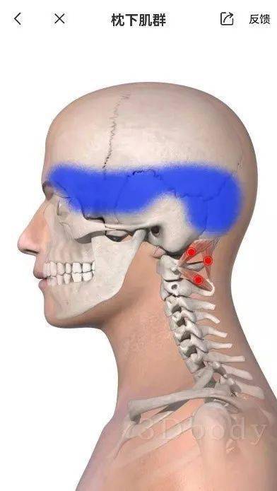 肌的触发点可以引发前额部疼痛☆头痛的相关触发点常见的有胸锁乳突肌
