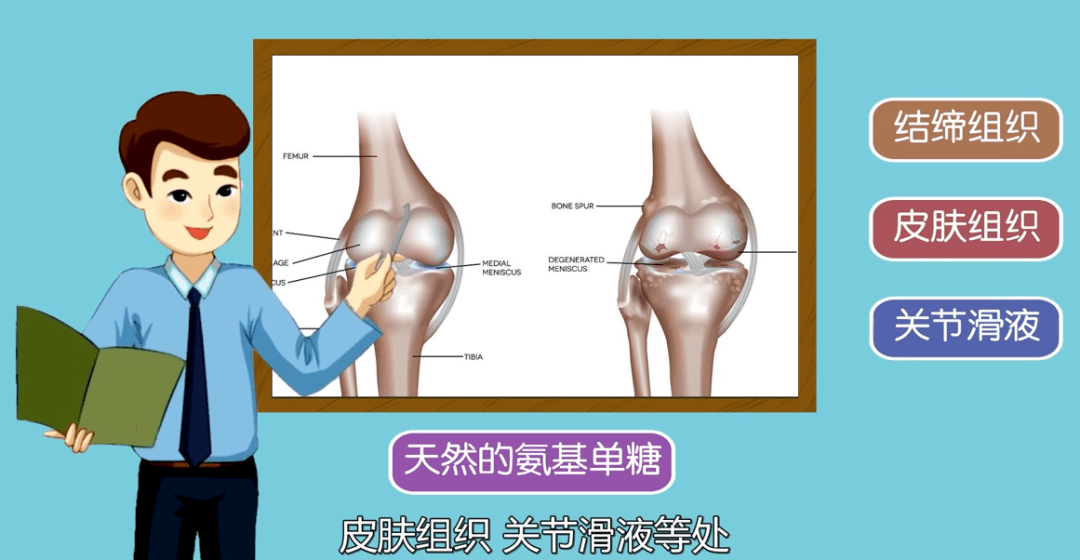 问题|我国膝关节炎患者达1.2亿，你的膝盖还剩多少寿命？