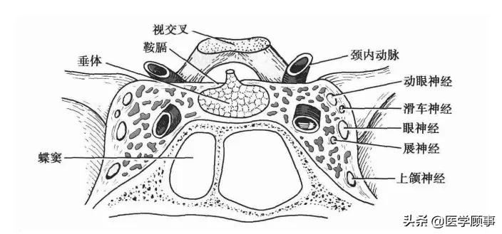 蝶鞍床突解剖图片