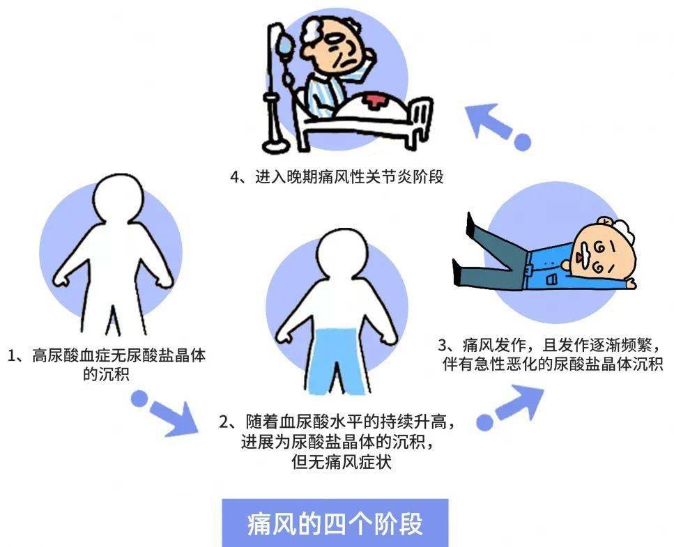 高血压合并高尿酸怎么办8个问答为您解惑