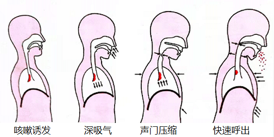 醫文醫話康復中心反覆發熱警惕隱性誤吸