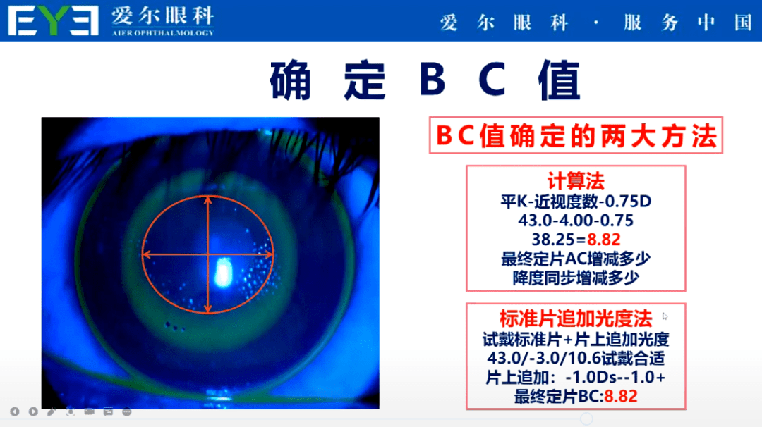第三,准确计算好bc此外,也可以通过观察荧光素染色情况来选择,如果