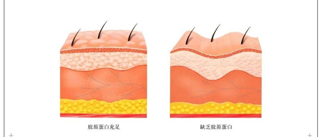 抗衰丨延缓皮肤衰老,重塑皮肤弹性,干细胞使肌肤恢复年轻状态成为可能_研究_Ther_真皮