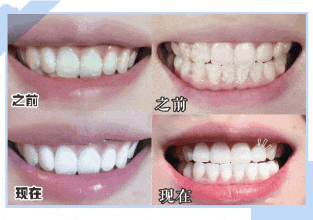 再生|牙齿上裹层“膜”，竟能让牙齿“再生”，烂牙变好牙！家家都有这材料