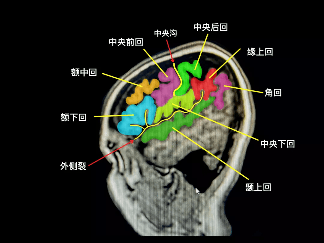 大脑半球叶间沟图片