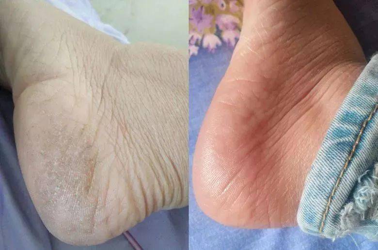 身体乳别用了身上干燥掉屑开裂换这个滋润感十足