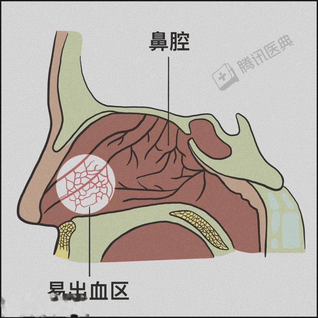 鱼刺卡喉流鼻血仰头别再这样自杀式急救了
