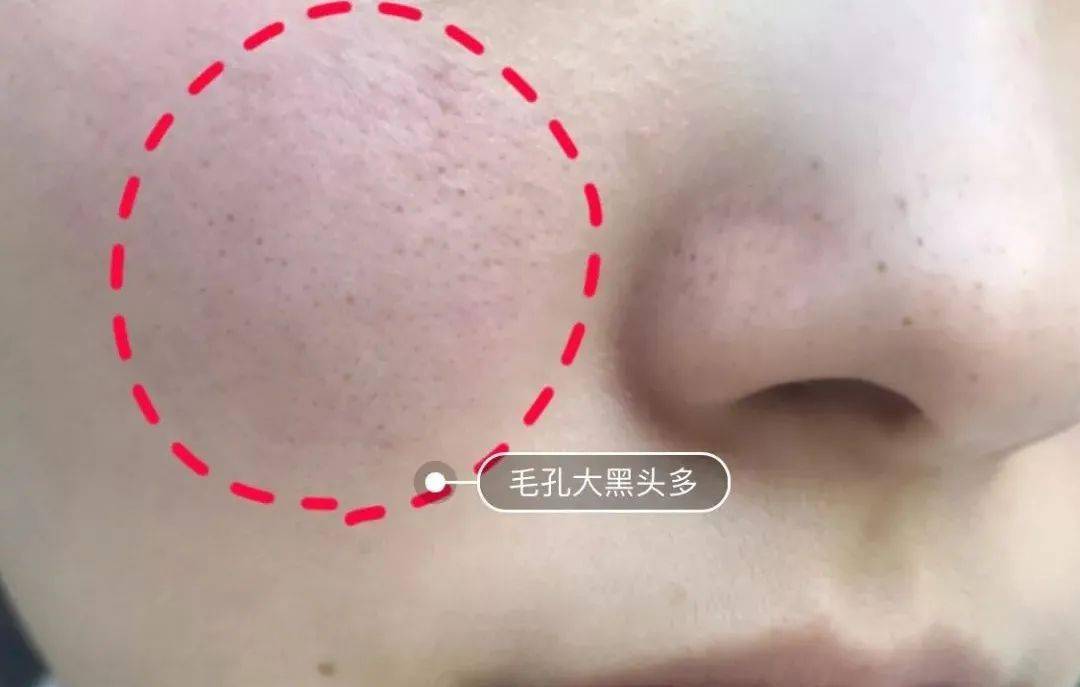 优惠新年捡漏：兰蔻小黑瓶直降1000！抱歉，这么大优惠说晚了...