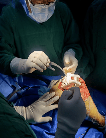 精准精确精细山东大学齐鲁医院德州医院关节外科成功实施3d打印技术