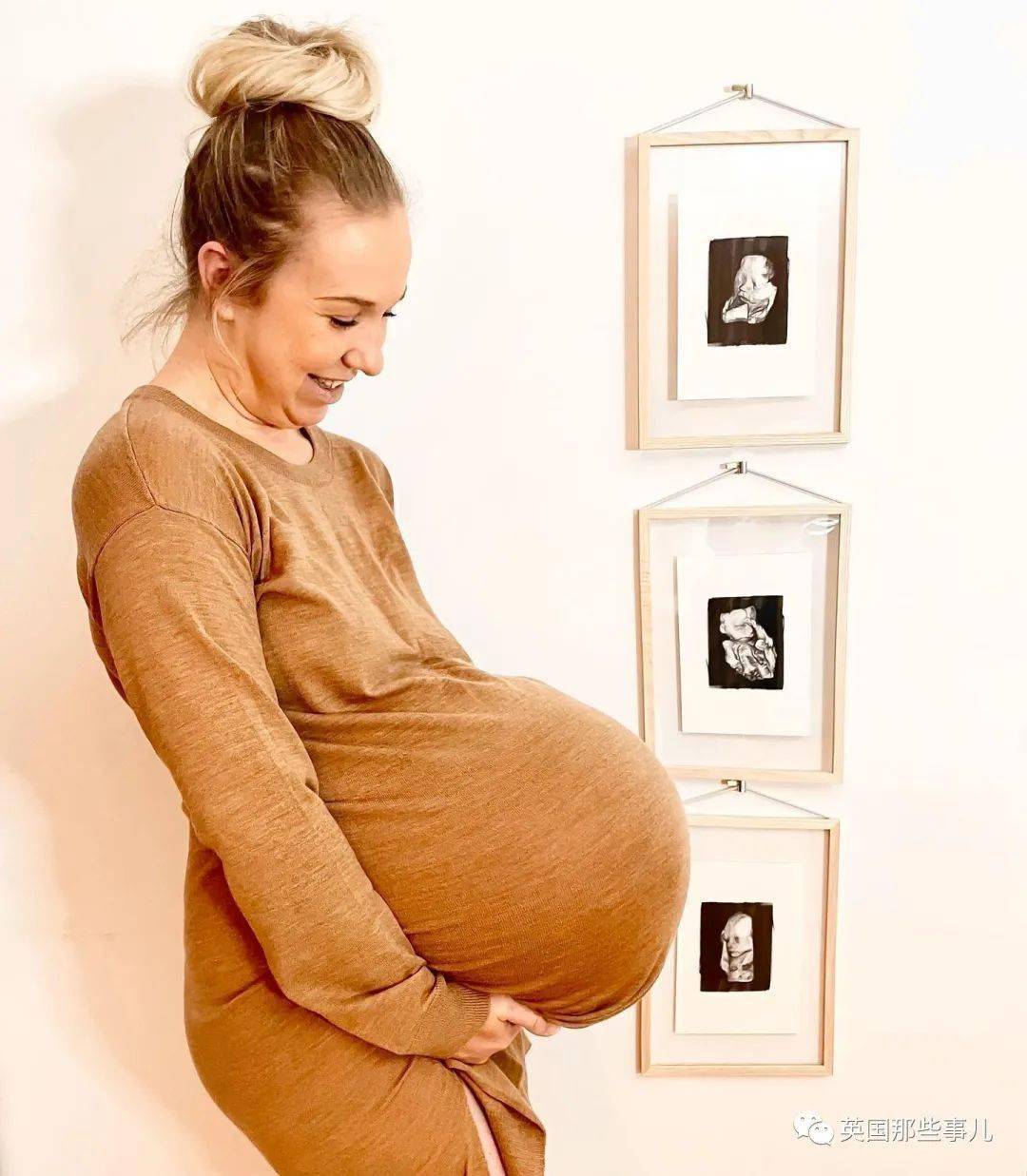 丹麦妈妈晒三胞胎孕肚,横向生长布满血丝,几乎悬浮身体之外?