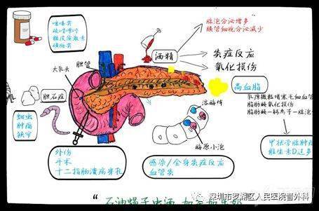 過年了就放開吃當心急性胰腺炎