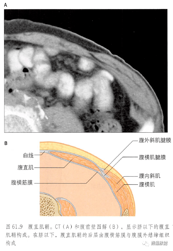 解剖丨腹部與盆部,腹前壁~_結構_內容_總體