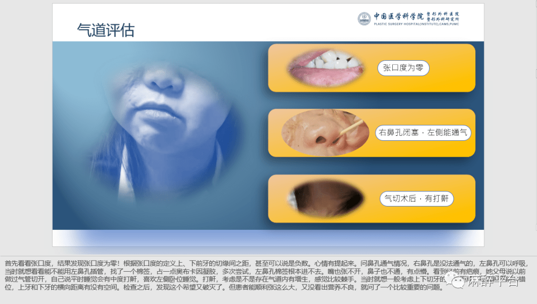 首先看看张口度,结果发现张口度为零!