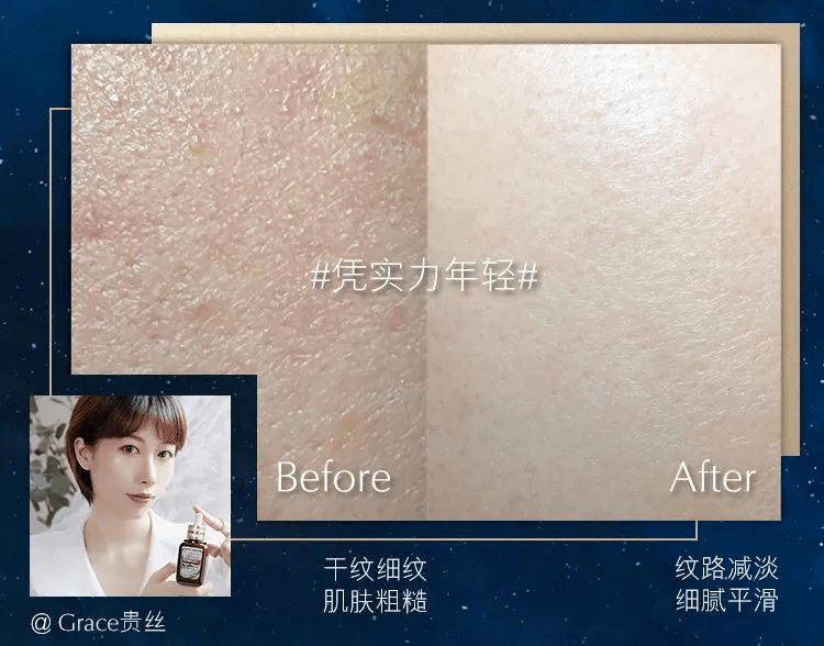 品牌专柜正品 | 雅诗兰黛骨折价限量抢，送眼霜、精华小样，买一送3
