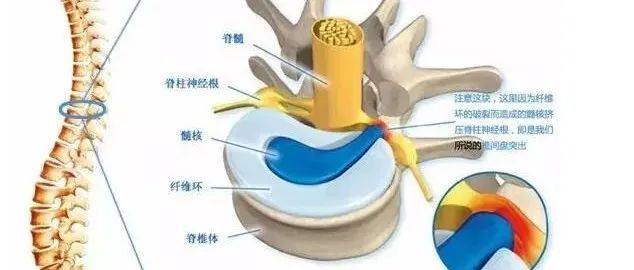 腰椎病的常见3大表现是什么？_腰椎间盘_神经_腰部