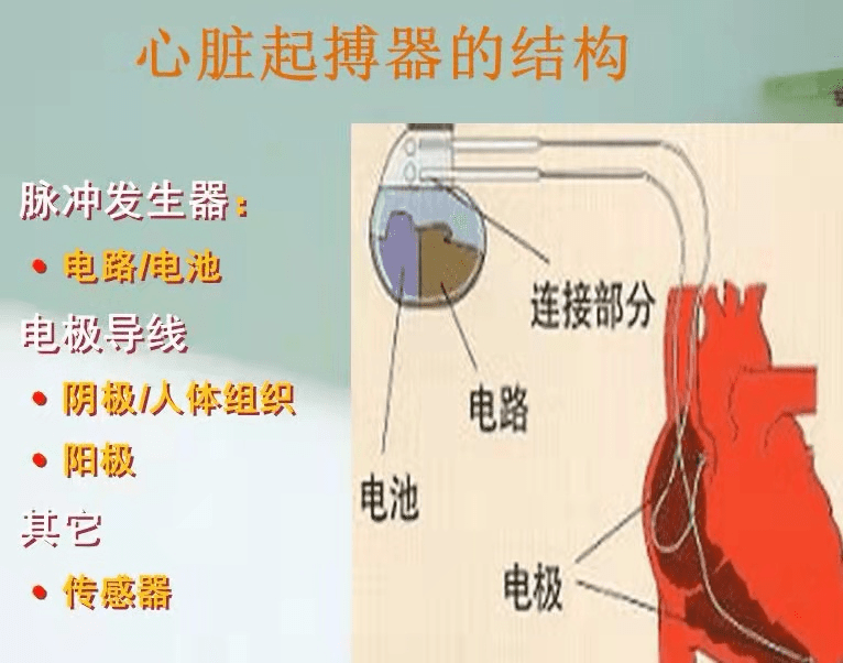 心脏起搏器的副作用图片