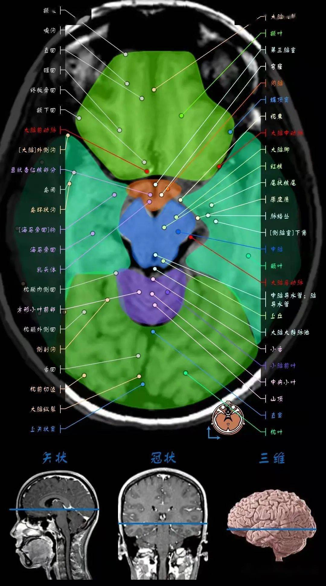 顱腦mri超詳細三維標註(最新版)_全網_影像_解剖圖