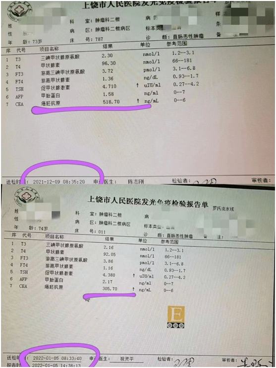 73岁直肠癌患者全身多处转移吃药仅1个月复查指标大降