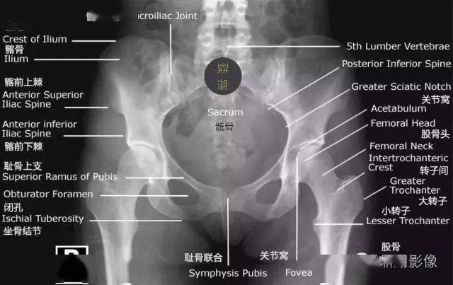 骨盆x光片各部位图解图片