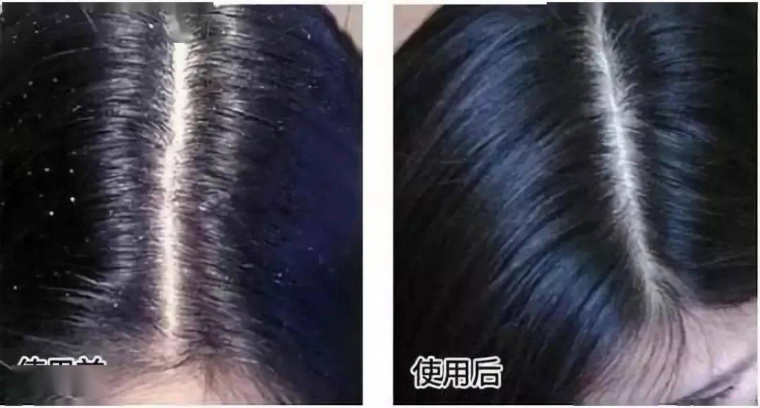 因为散着头发睡觉更健康？99%的女生都做错了，难怪头发油腻还脱发！