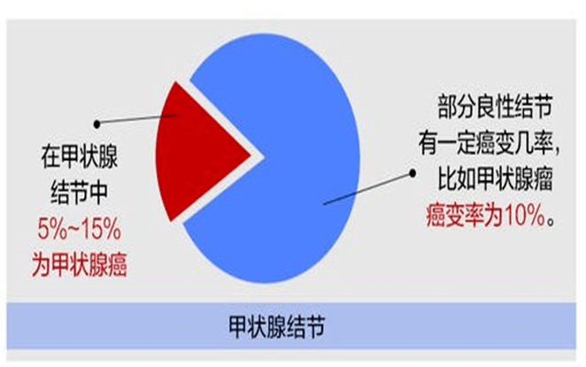 我院內分泌科開設甲狀腺結節微創治療門診