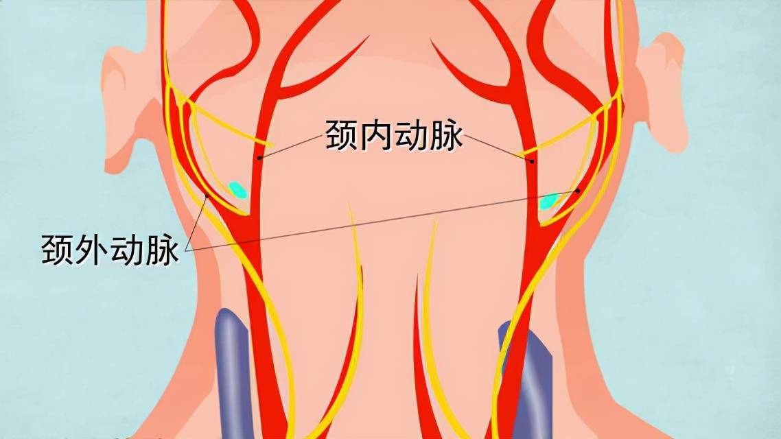 颈动脉的图片和示意图图片