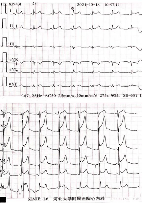 心肌炎的病例报告图片图片