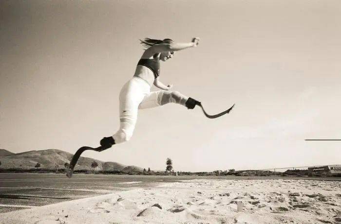 全球身高1米4,却被封“全球最美双腿”,网友:她美哭我了