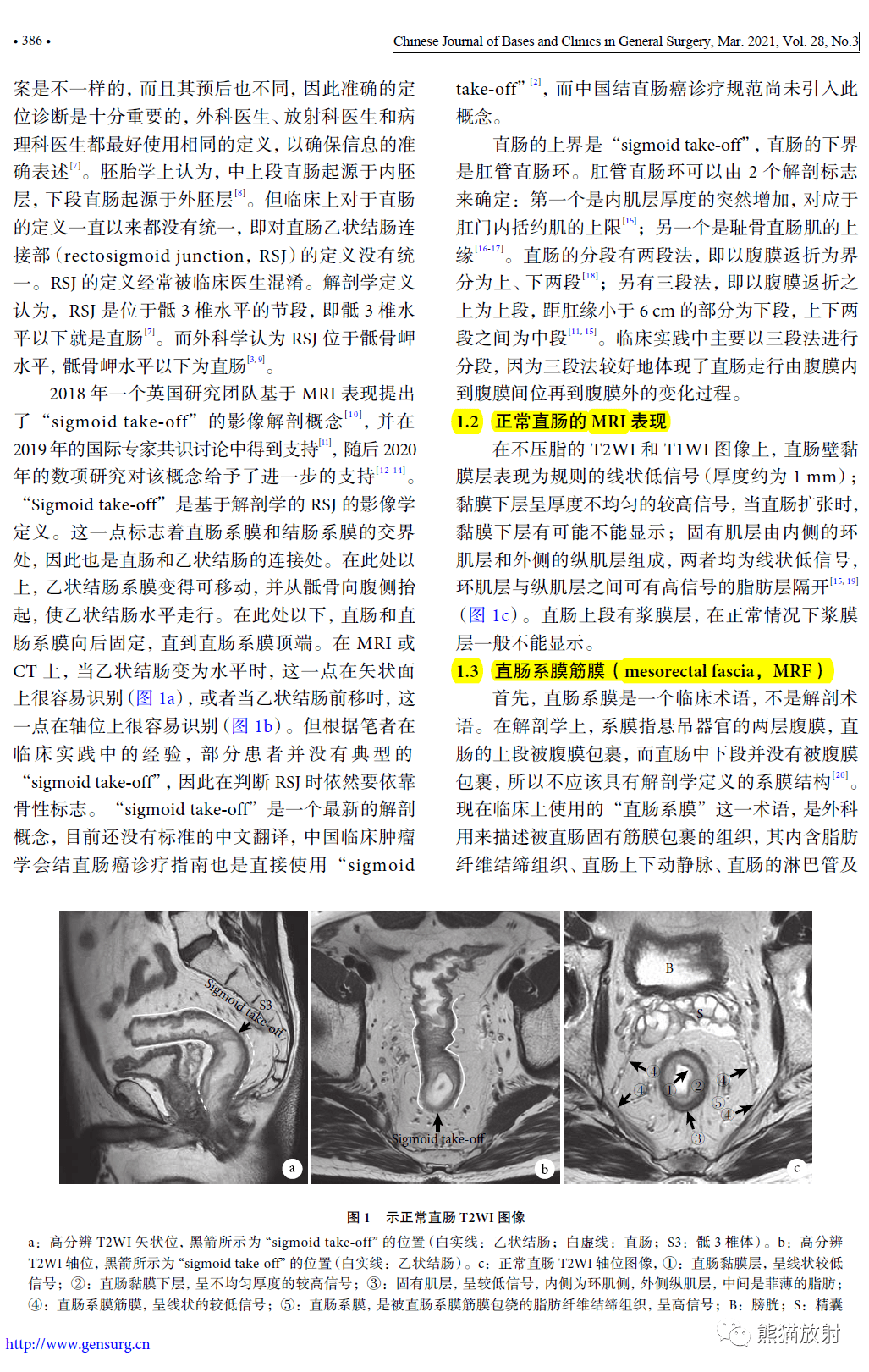 环周切缘(crm)肠壁外血管侵犯(emvi)直肠系膜筋膜(mrf)相关英文缩写