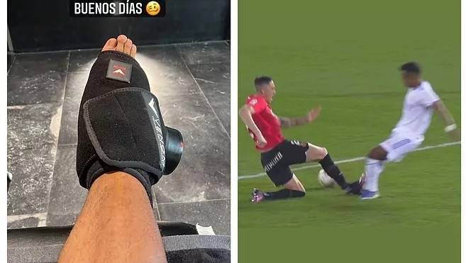 马洛卡|回击马洛卡球员！罗德里戈晒出受伤瞬间和脚踝最新状况的图片