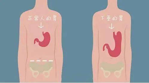 胃在右边还是左边图片