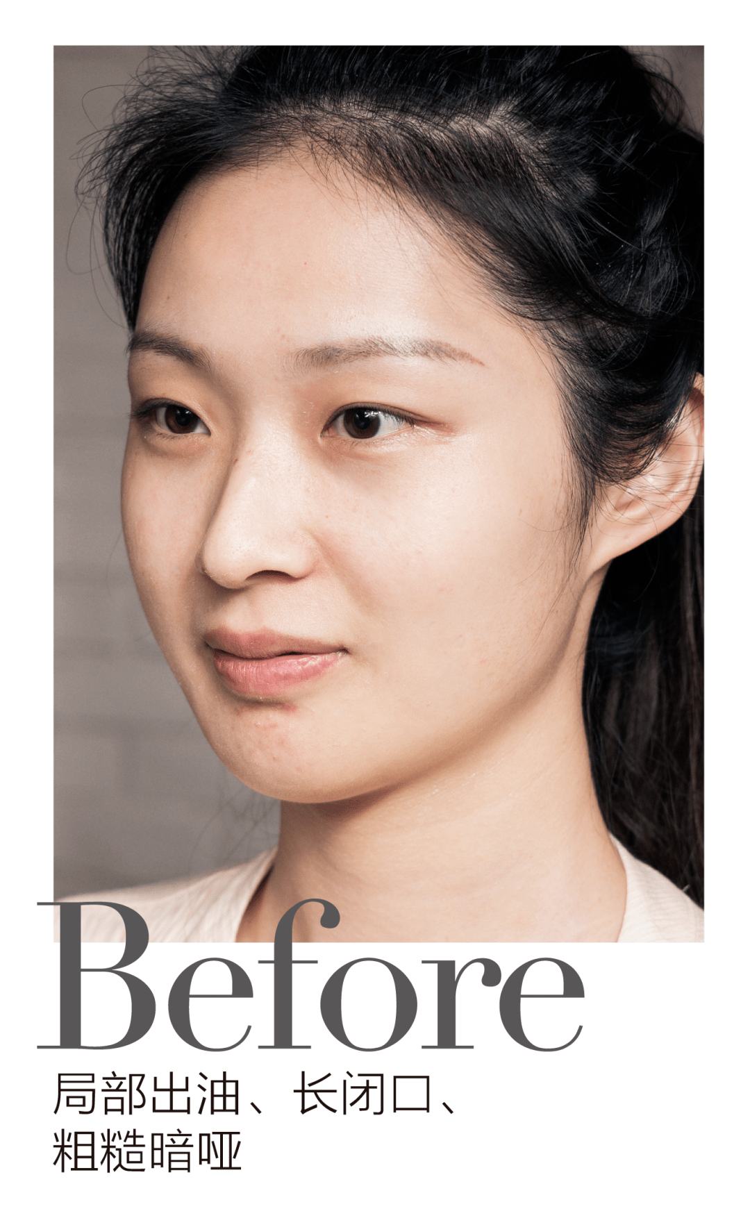 治愈美肤驿站 | 春日之下,治愈肌肤与心灵!