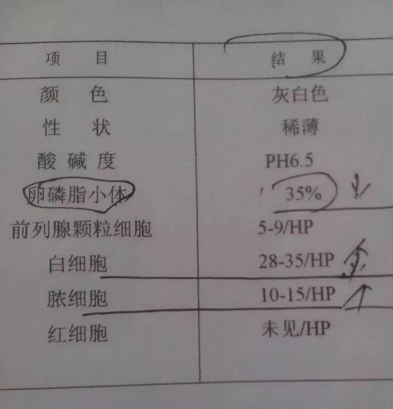 前列腺炎性分泌物图片图片