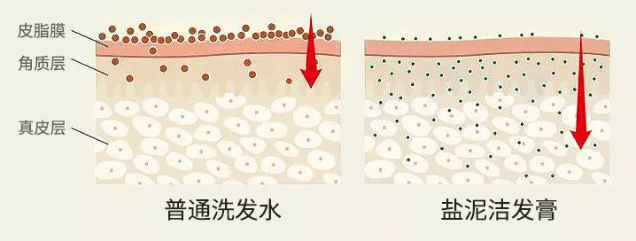 洗头头皮油脂“清道夫”!千年盐湖盐泥+北极光云杉,3天不洗头不油也不痒,头发像丝绸一样顺滑!