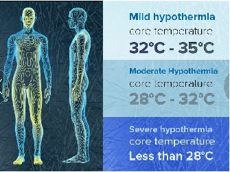 1997年在《新英格兰医学杂志》上提出围术期低体温,并将核心体温低于