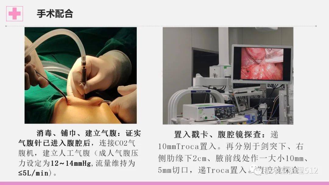 ppt腹腔鏡下膽囊切除術多孔個案護理