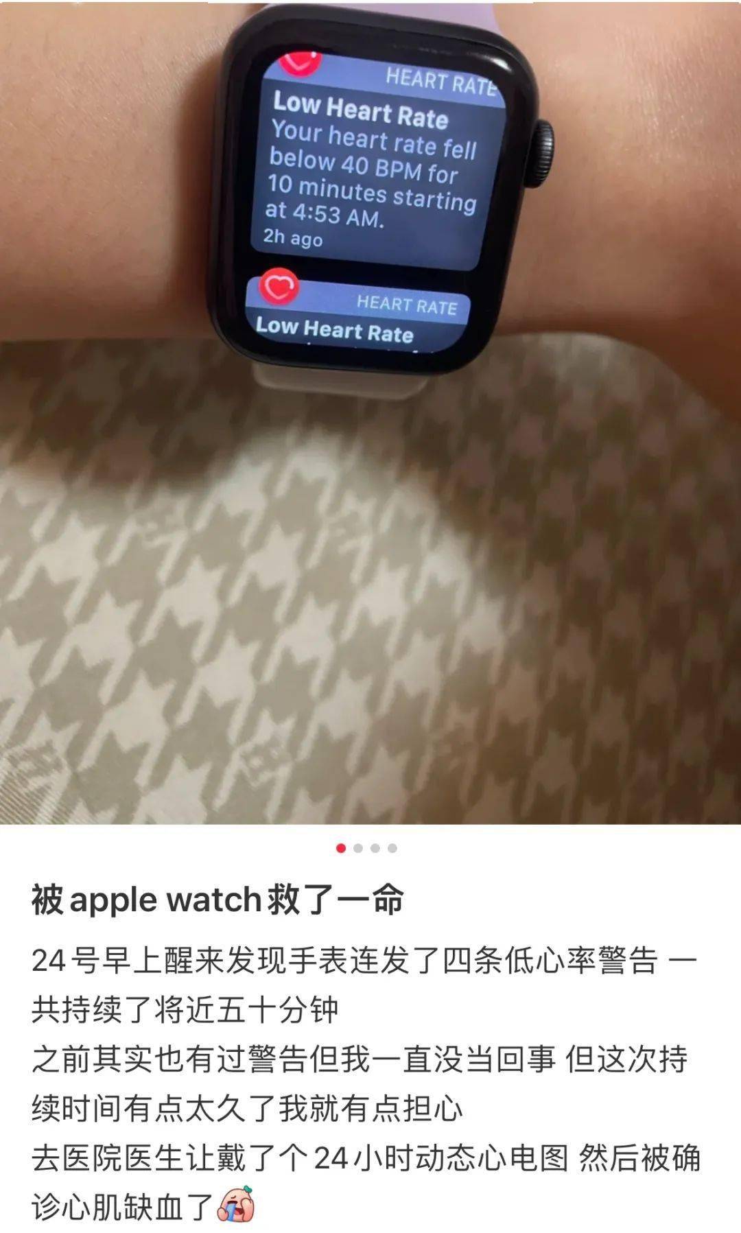 功能|夜里三点打手冲，智能手表以为我“在划船”