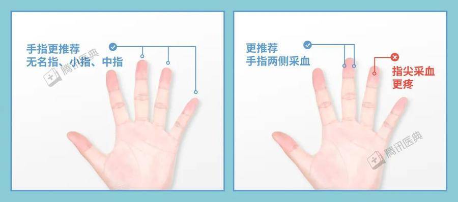 在家测血糖最全指南,转给身边需要的人_手指_监测_患者