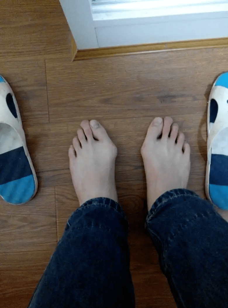 为什么女生会因为脚大而焦虑