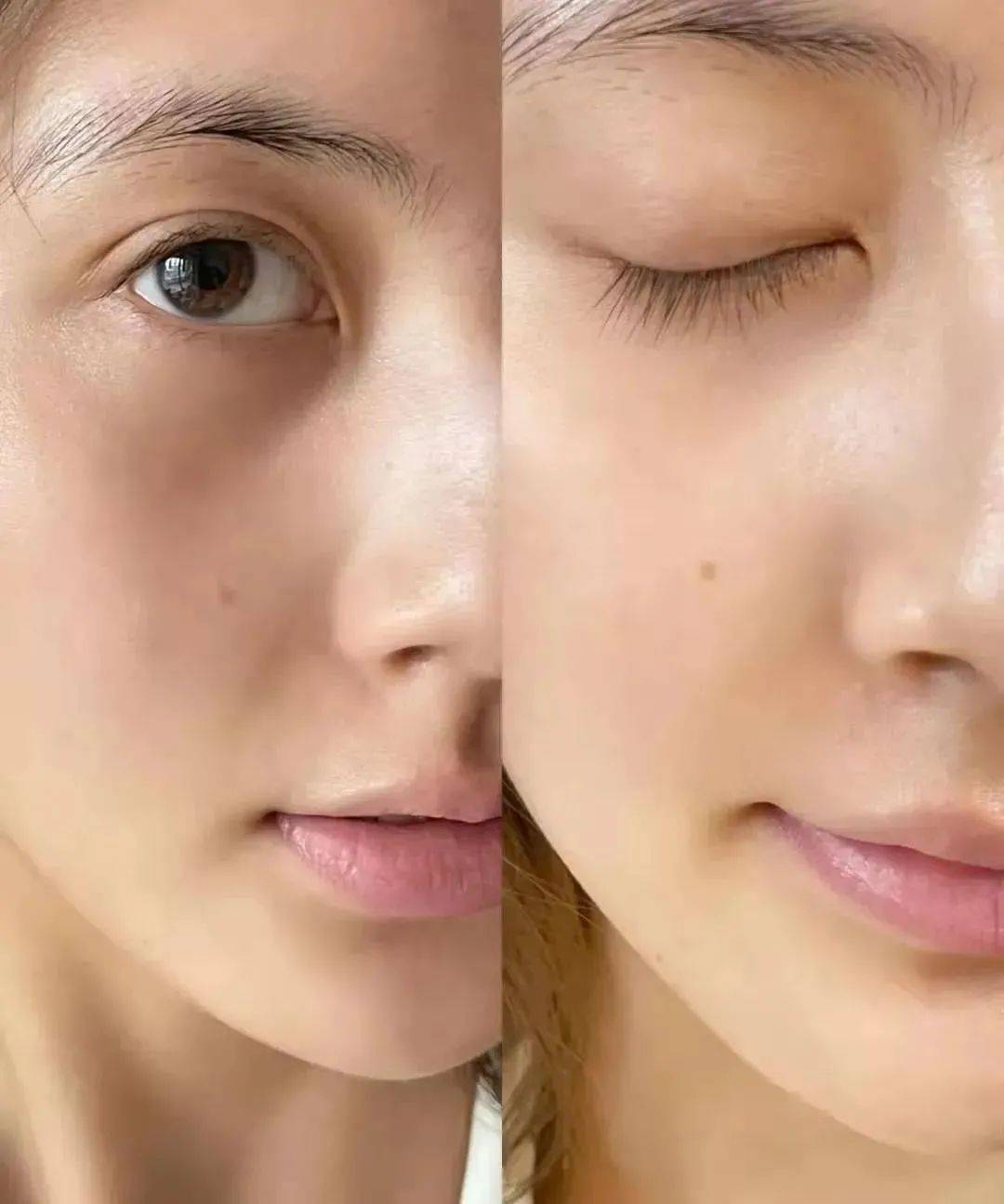 毛孔明星好皮肤是怎么养成的？
