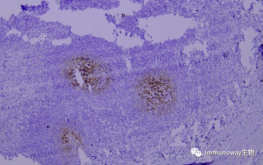 免疫组化ihc│常见问题及解析集锦
