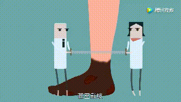 糖尿病足截肢率高,治疗难度大,如何预防才是关键!