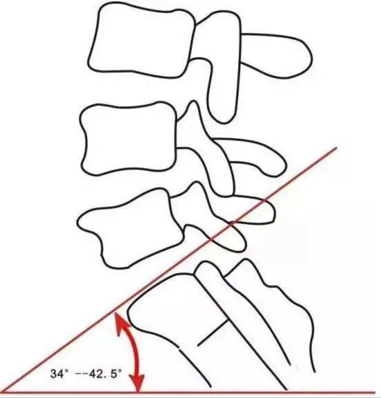 腰骶三角区定位图片