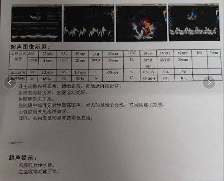 心梗检查报告图片图片